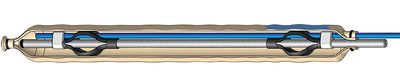 Stainless steel reinforcement 